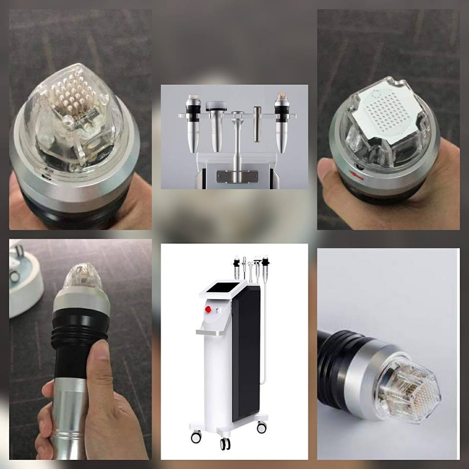 Sanhe FRACTIONAL RF MICRONEEDLE (FRM)1_9186181060340219904_n